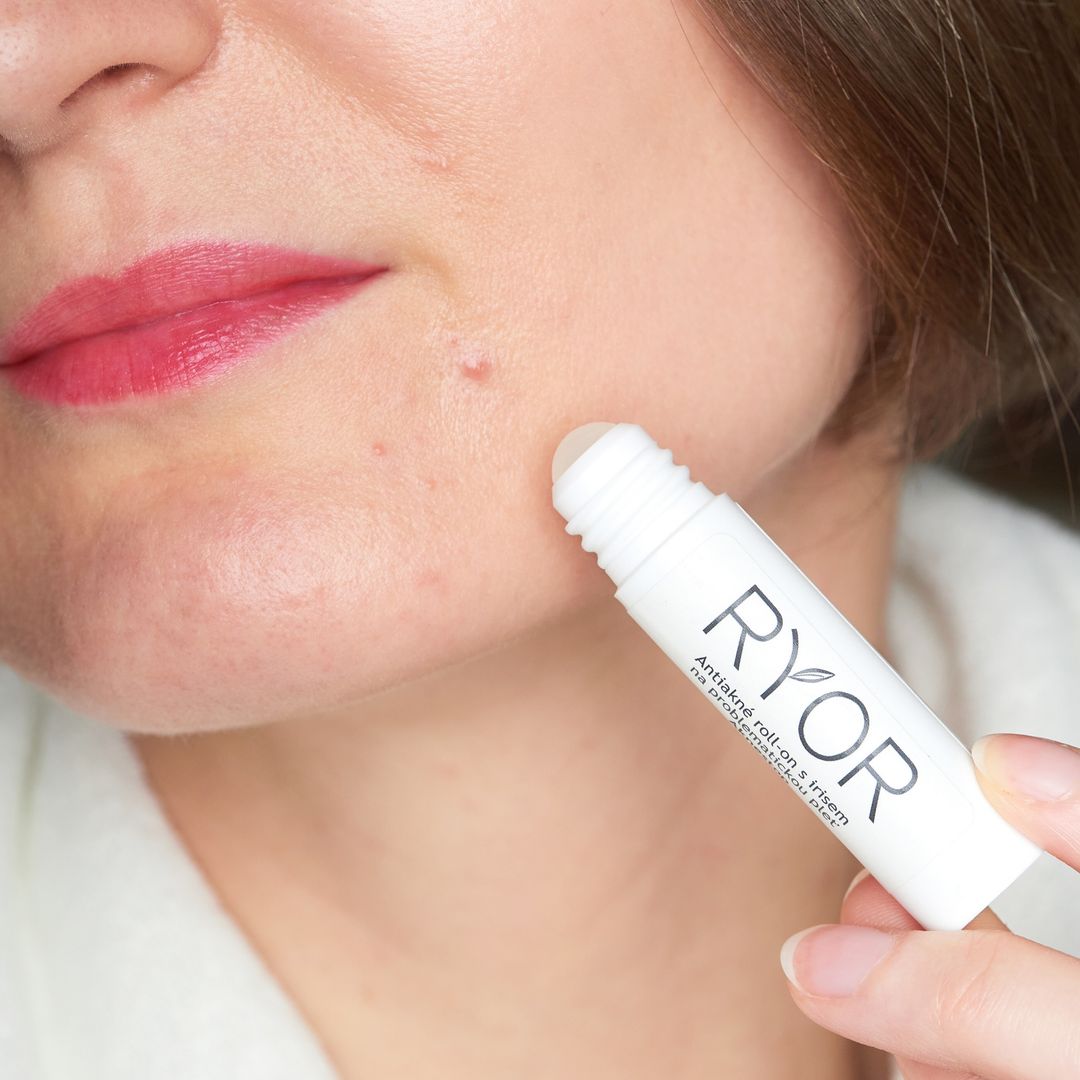Antiakné roll-on s irisom na problematickú pleť - galéria #3